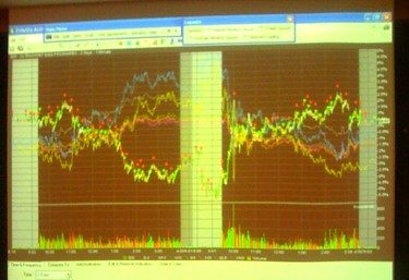 eToro Beats Q2 Profit Targets Despite Trading Slowdown