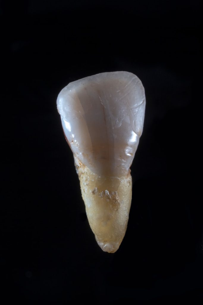 Sperm whale tooth unearthed in Valencina